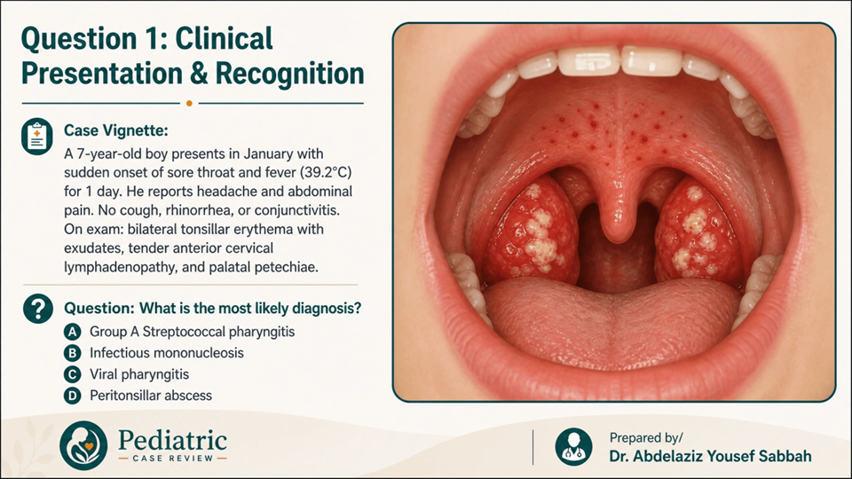 Acute Tonsillitis