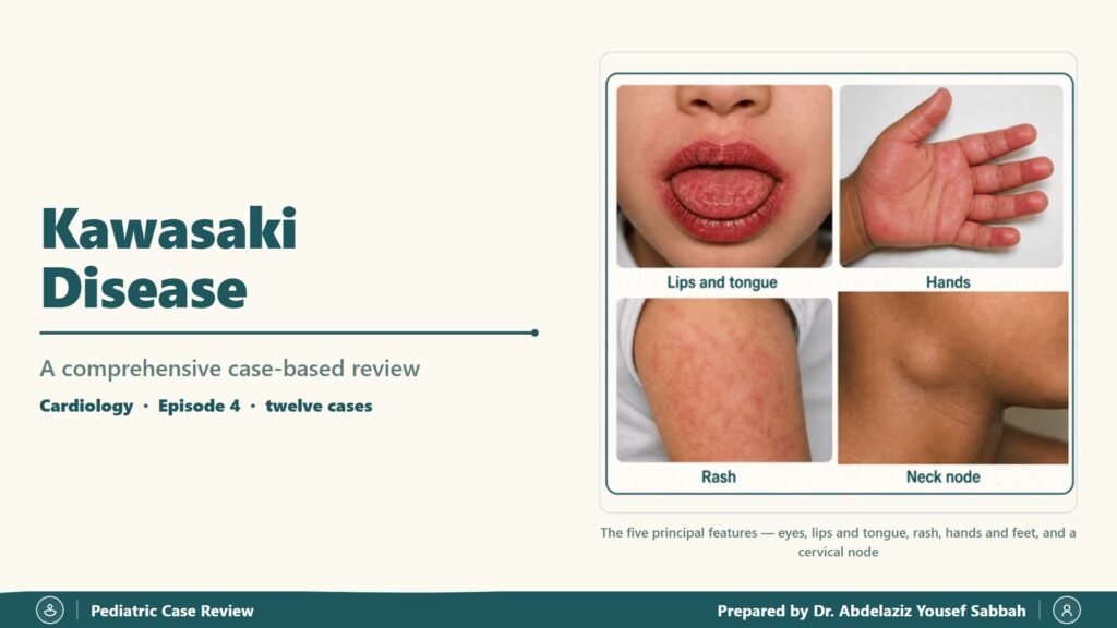Kawasaki Disease slide 1
