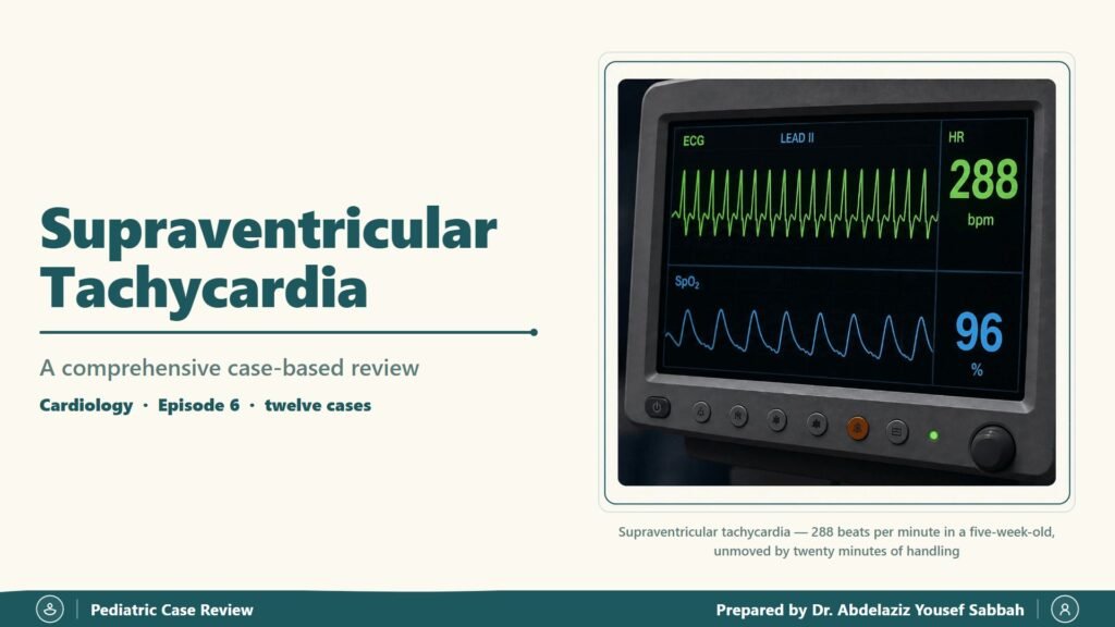 Supraventricular Tachycardia slide 1