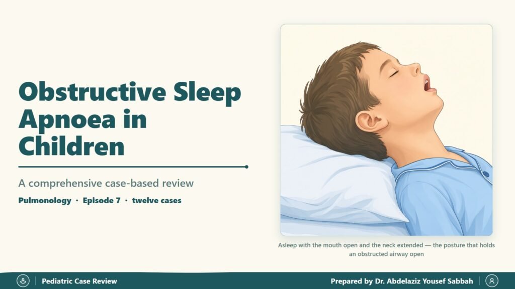 Obstructive Sleep Apnoea slide 1