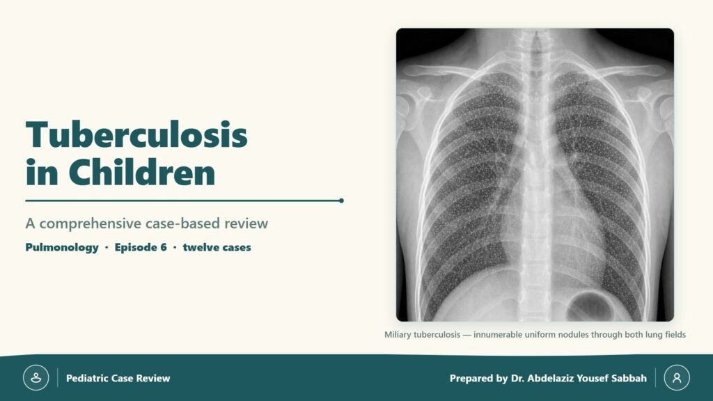 Tuberculosis in Children slide 1