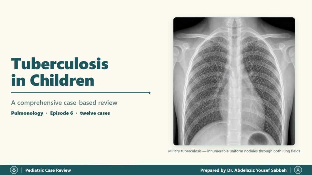 Tuberculosis in Children slide 1