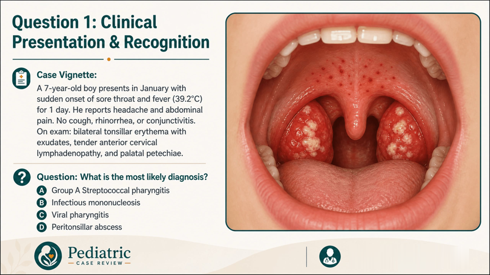 Acute Tonsillitis