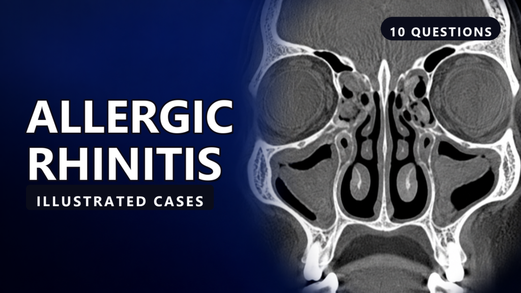 Allergic Rhinitis - Illustrated Cases - illustrated cases thumbnail