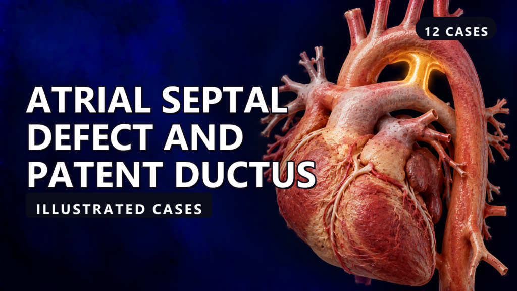 Atrial Septal Defect and Patent Ductus - illustrated cases thumbnail