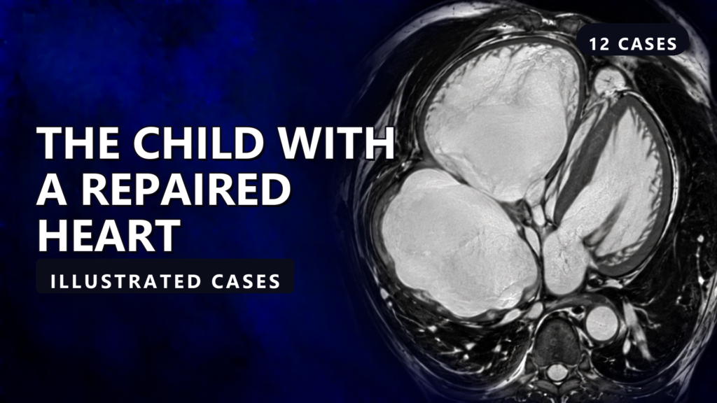 The Child with a Repaired Heart - illustrated cases thumbnail