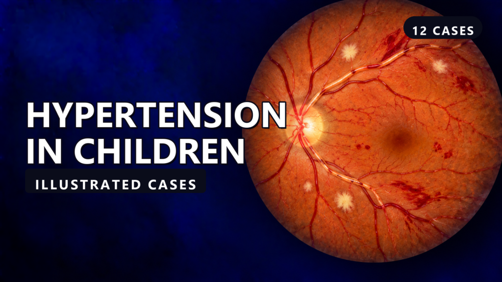 Hypertension in Children - illustrated cases thumbnail