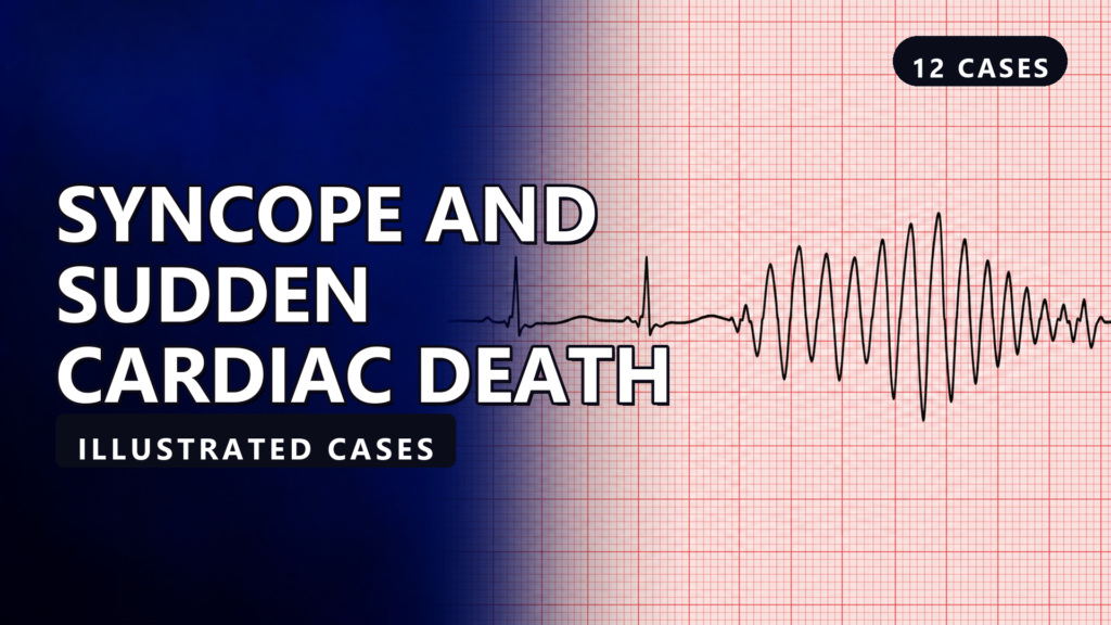 Syncope and Sudden Cardiac Death - illustrated cases thumbnail