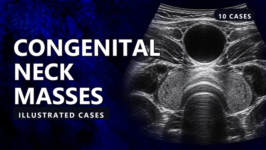 Congenital Neck Masses - illustrated cases thumbnail