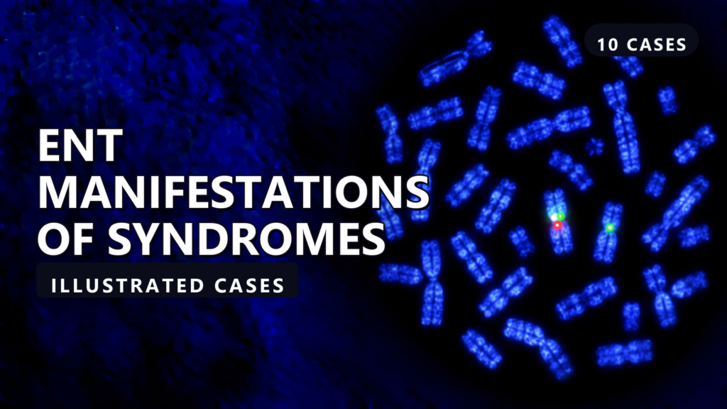 ENT Manifestations of Syndromes - illustrated cases thumbnail