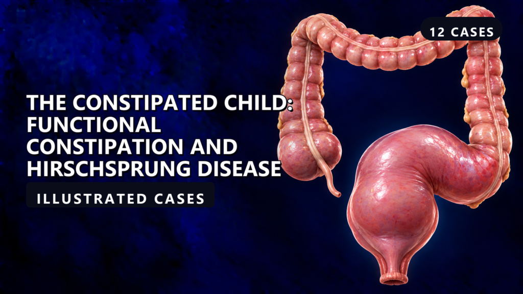 The Constipated Child: Functional Constipation and Hirschsprung Disease - illustrated cases thumbnail