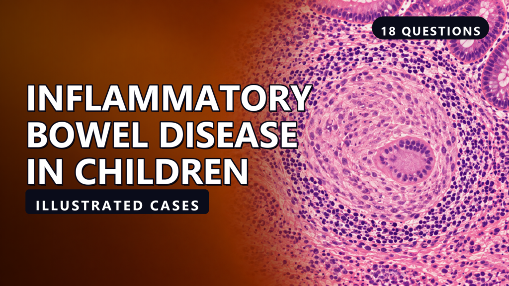 Inflammatory Bowel Disease in Children - illustrated cases thumbnail
