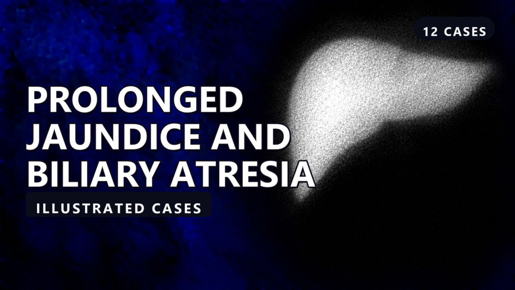Prolonged Jaundice and Biliary Atresia - illustrated cases thumbnail