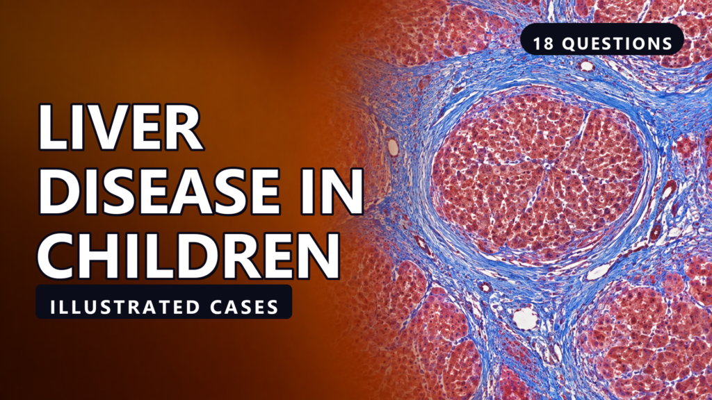 Liver Disease in Children - illustrated cases thumbnail