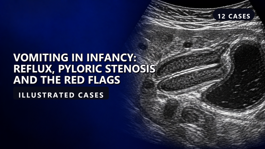 Vomiting in Infancy: Reflux, Pyloric Stenosis and the Red Flags - illustrated cases thumbnail