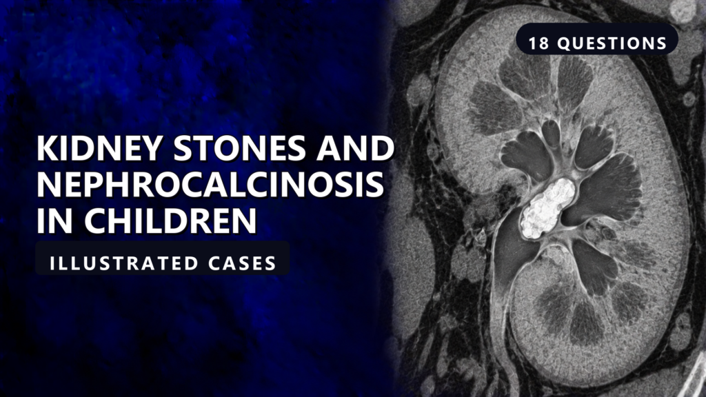 Kidney Stones and Nephrocalcinosis in Children - illustrated cases thumbnail