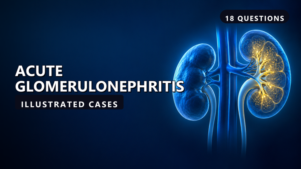 Acute Glomerulonephritis - illustrated cases thumbnail