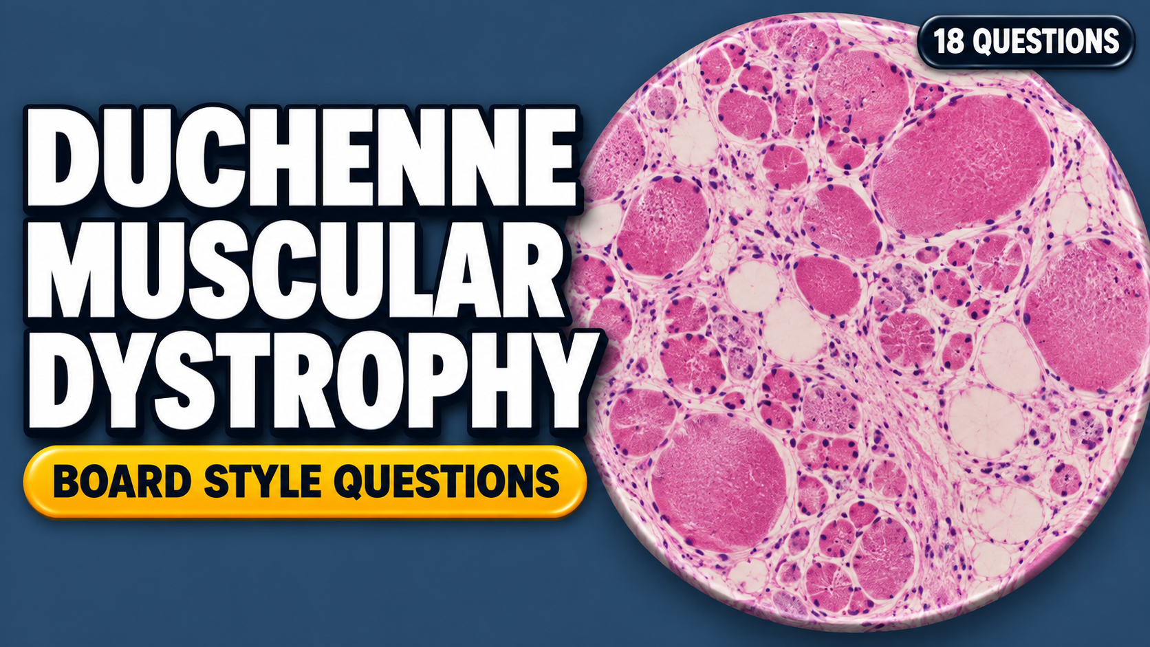 Photo: pediatriccasereview.com Duchenne Muscular Dystrophy – Board-Style Questions