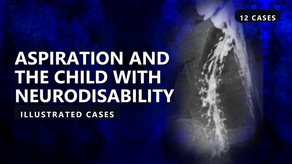 Aspiration and the Child with Neurodisability - illustrated cases thumbnail