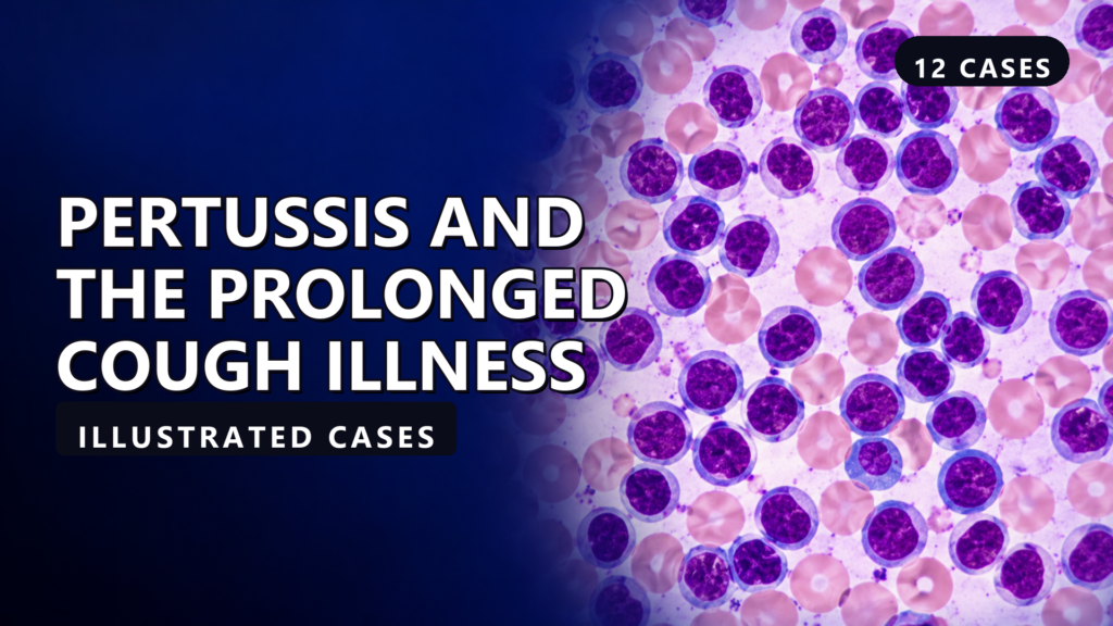 Pertussis and the Prolonged Cough Illness - illustrated cases thumbnail