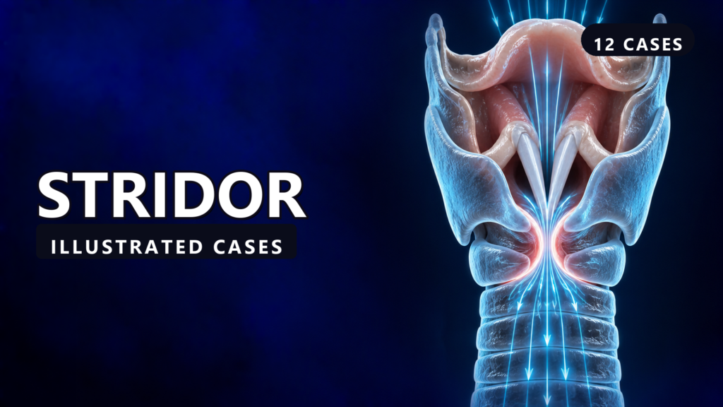 Stridor - illustrated cases thumbnail